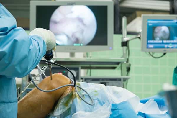 Knee Arthroscopy Key Hole Surgery